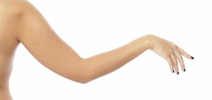 brazo de mujer esbelto y sin flacidez gracias a tratamiento medicina estética mesoterapia