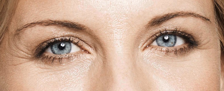 detalle de los ojos de una mujer despues de tratar las arrugas del entrecejo
