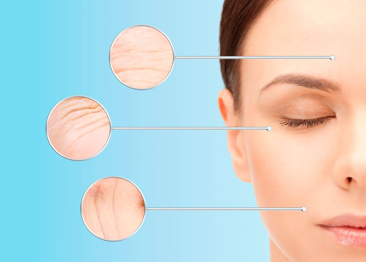 Mitad de rostro de mujer en fondo azul con señalización y zoom en las zonas del rostro en las que actúa el tratamiento facial Volite
