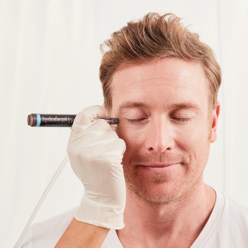 Hombre recibiendo tratamiento Hydrafacial Perk en contorno de los ojos para reducir las ojeras e iluminar mirada
