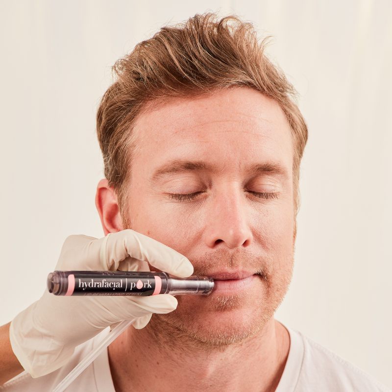 Hombre recibiendo tratamiento Hydrafacial Perk en labios para conseguir hidratación profunda