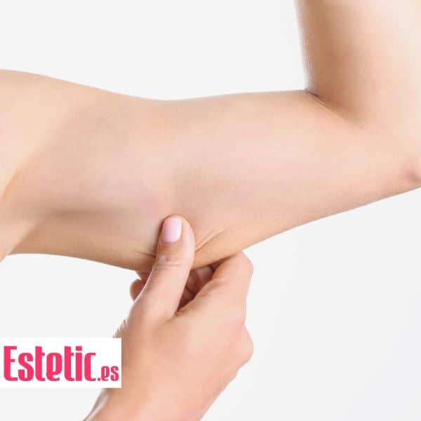 Imagen de un artículo publicado en Estetic.es donde aparece el brazo de una mujer con flacidez